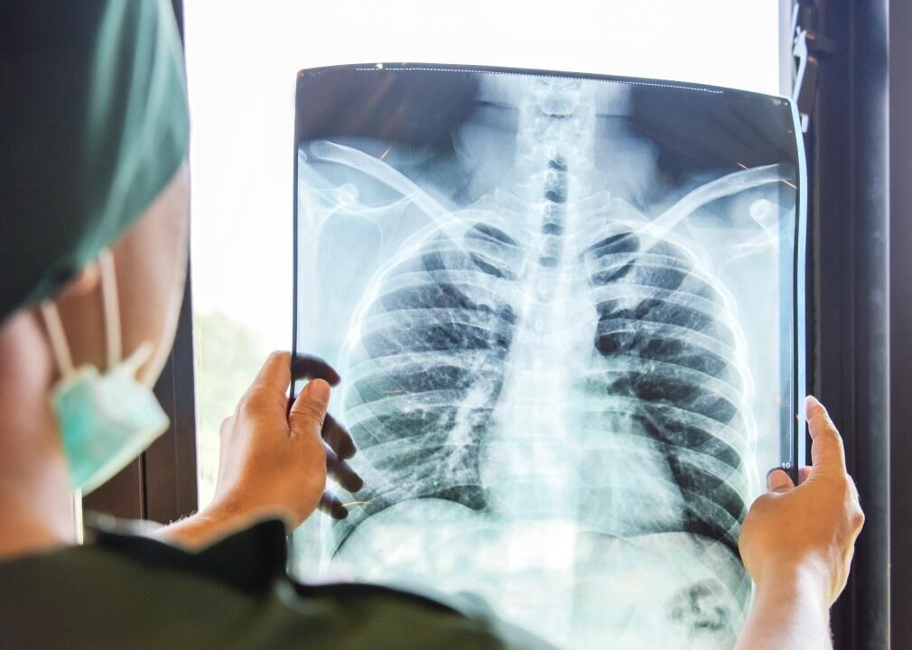 #44. Radiography